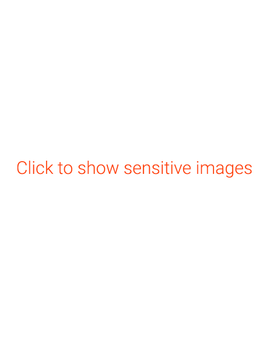 Click to show sensitive images